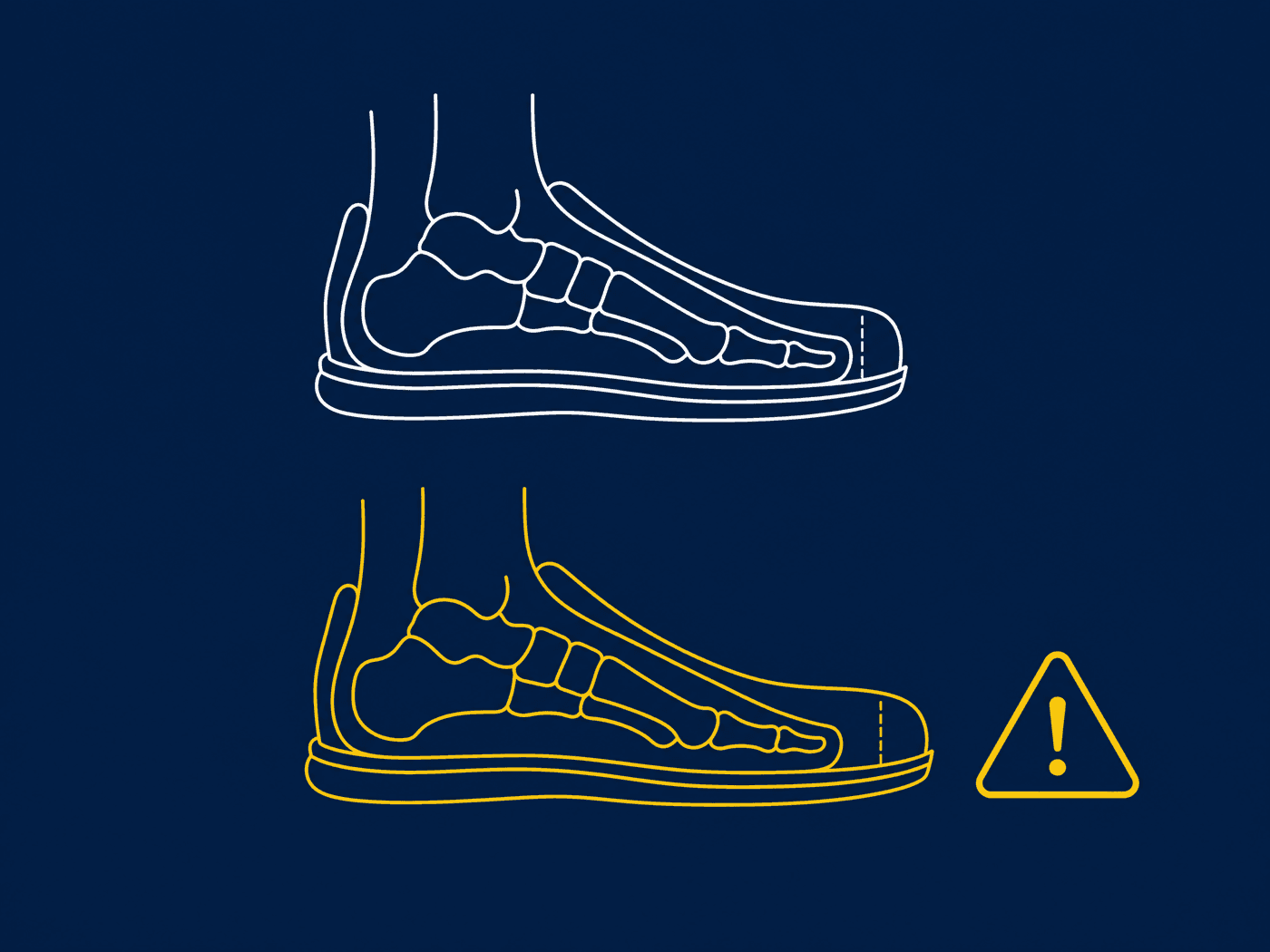 Diagram comparing a correct toe gap with an excessive one